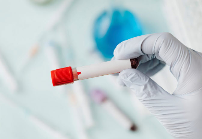 Genetik Testlerin Bireysel Sağlık Planlamasında Kullanımı